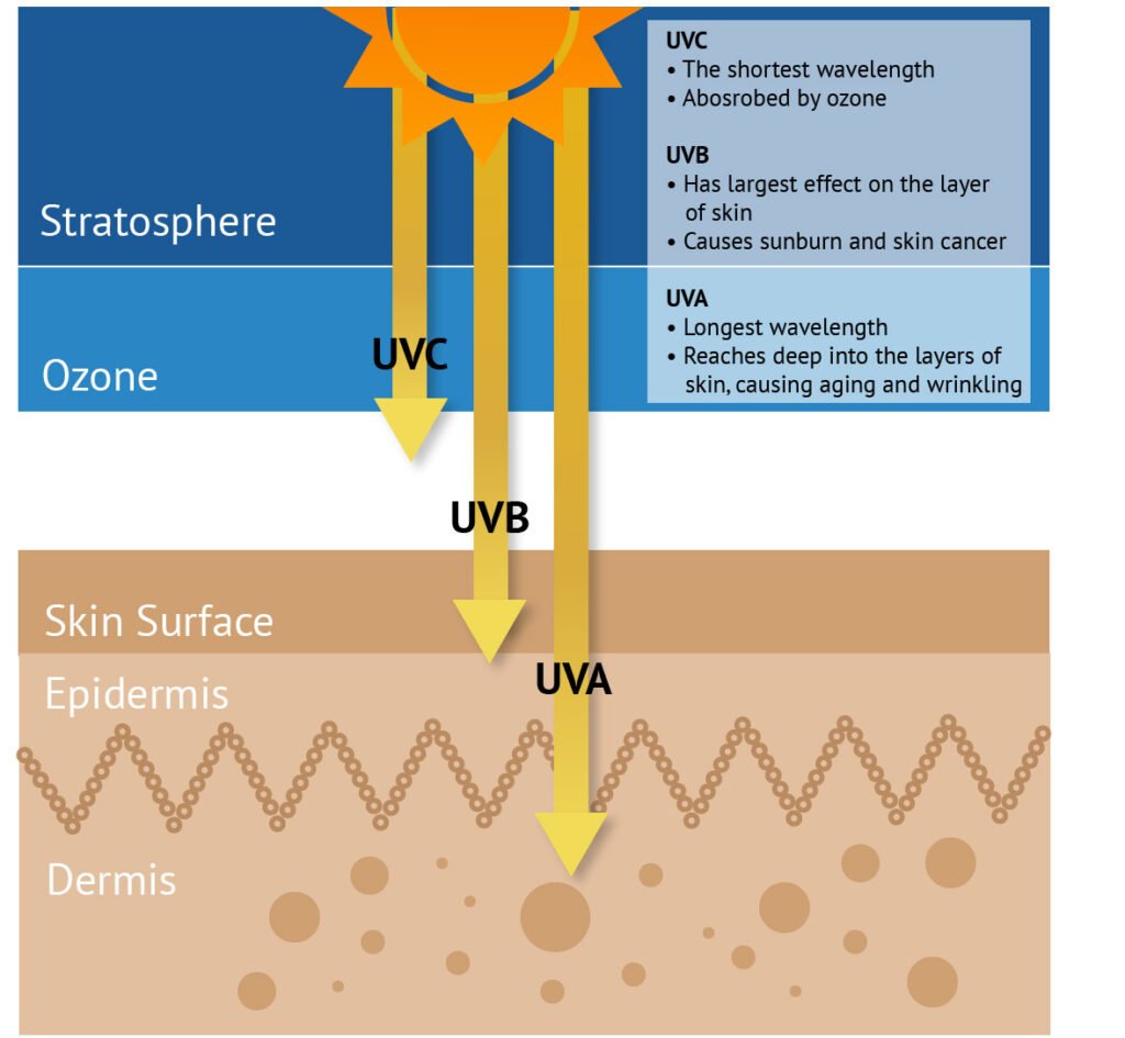 UV-Rays-Damage-Skin